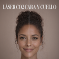 Láser CO2 Cara y Cuello