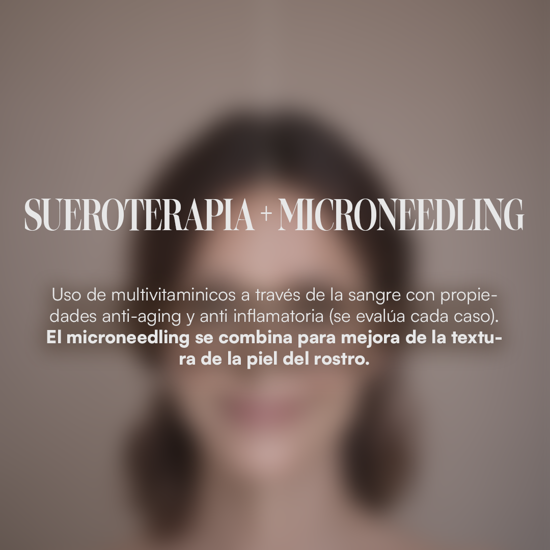 Sueroterapia + Microneedling
