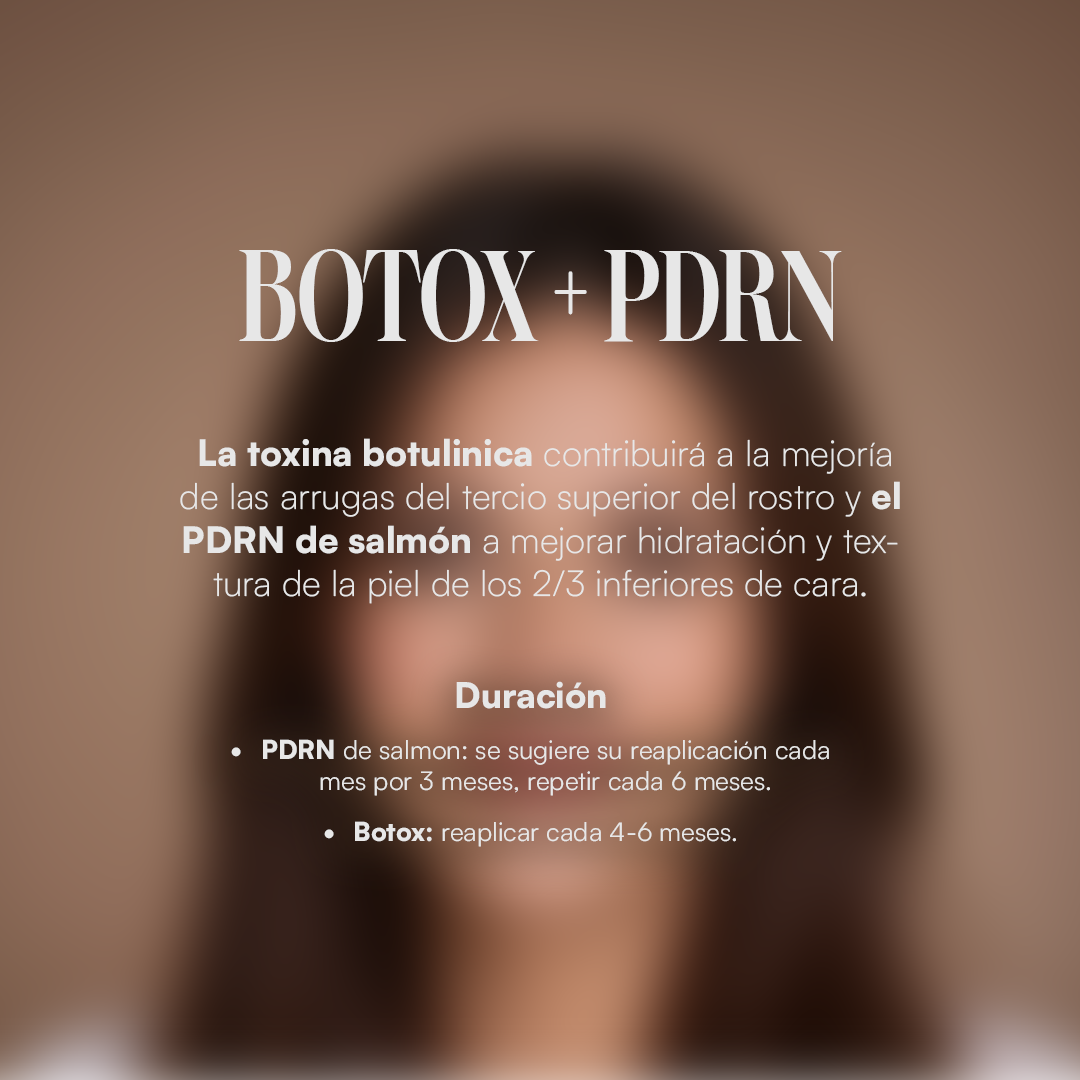Botox + PDRN