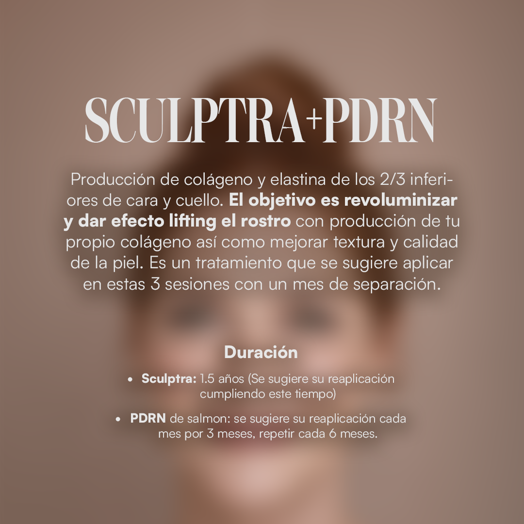 Sculptra + PDRN