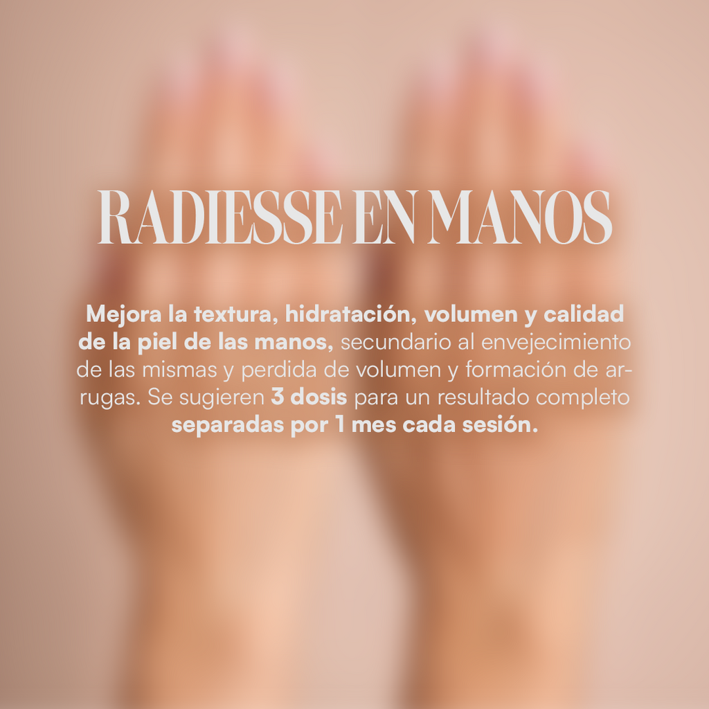 Radiesse en Manos
