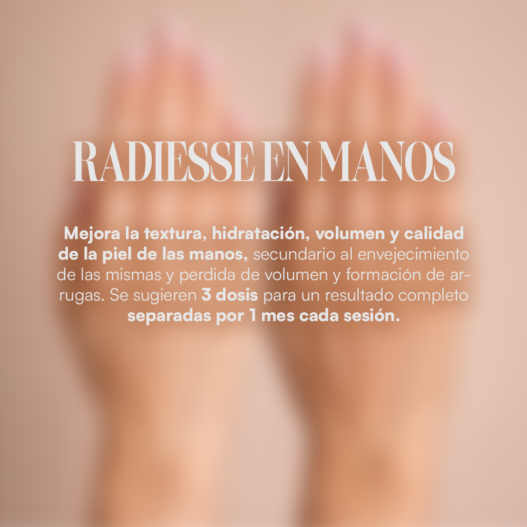Radiesse en Manos