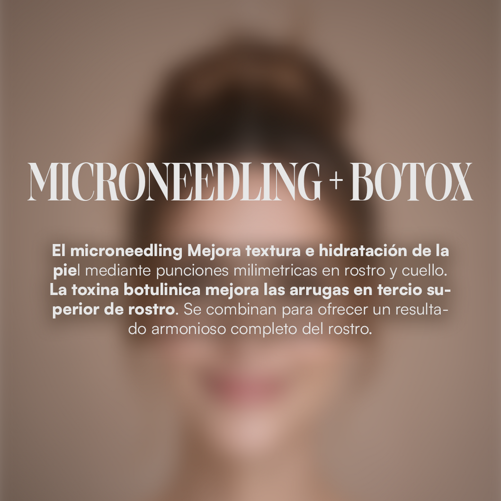 Microneedling + Botox
