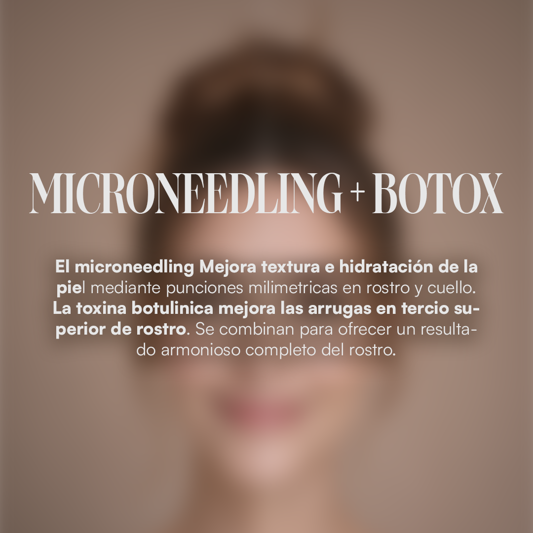Microneedling + Botox