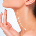Neck Lift